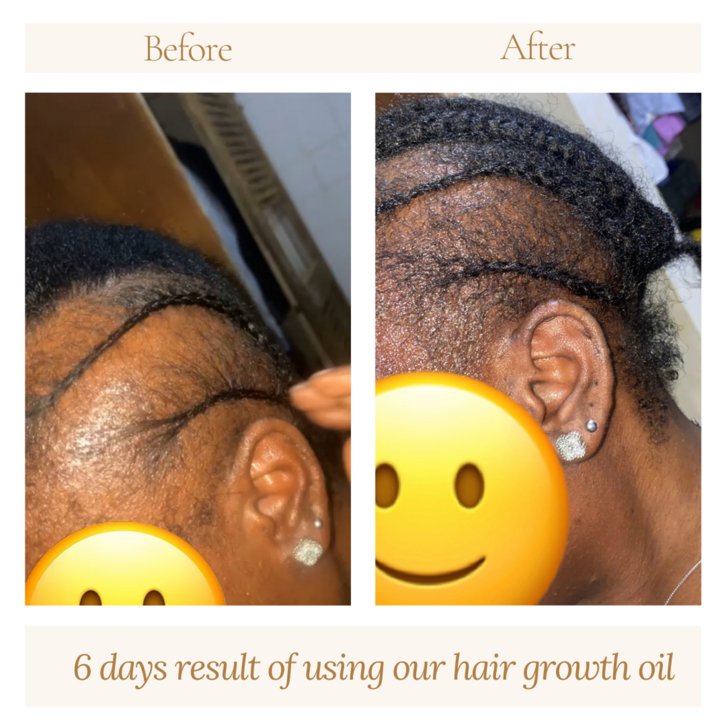 Before and after adult hair growth oil results